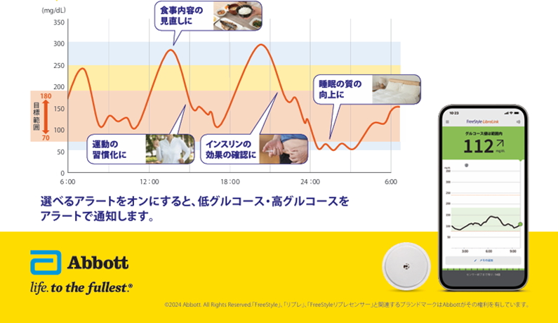 血糖モニタリング外来